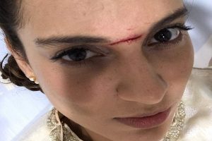 Kangana-Ranaut-Injured-mplive.co.in
