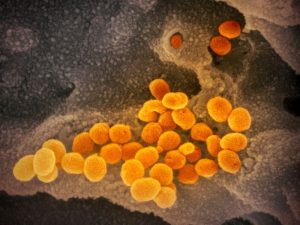 doctors-claim-corona-virus-spreads-deadly-fungal-infection-mplive